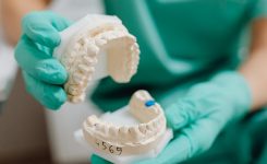 Todo lo que necesitas saber sobre la implantología dental