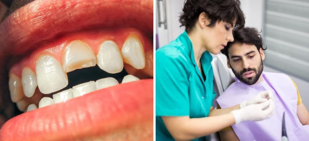 Soluciones y tratamientos para las fracturas dentales